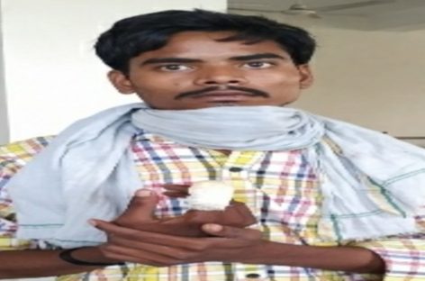 अब एआरडी इंडस्ट्रीज में कटी मजदूर की उंगली  पुलिस, नेता,  डॉक्टर,  लेबर कोर्ट…हर किसी ने राहुल को किया निराश