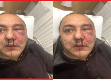 वकील दुग्गल पर हमला : पुलिस की शह पर पलते हैं गुंडे