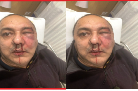 वकील दुग्गल पर हमला : पुलिस की शह पर पलते हैं गुंडे