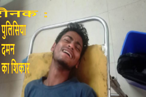 राजनीतिक दबाव के चलते पुलिस ने नाबालिग लडक़े को दिया थर्ड डिग्री
