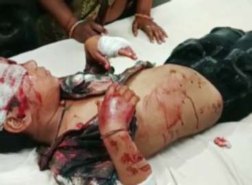 आवारा कुत्ते-सांड लोगों पर कर रहे हमला कोर्ट के आदेश की आड़ में चुपचाप बैठा नगर निगम प्रशासन