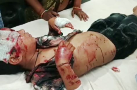 आवारा कुत्ते-सांड लोगों पर कर रहे हमला कोर्ट के आदेश की आड़ में चुपचाप बैठा नगर निगम प्रशासन