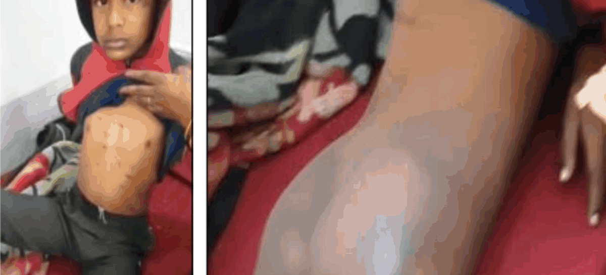 टॉर्चर के शिकार लड़के को हिन्दू होना भी न बचा पाया